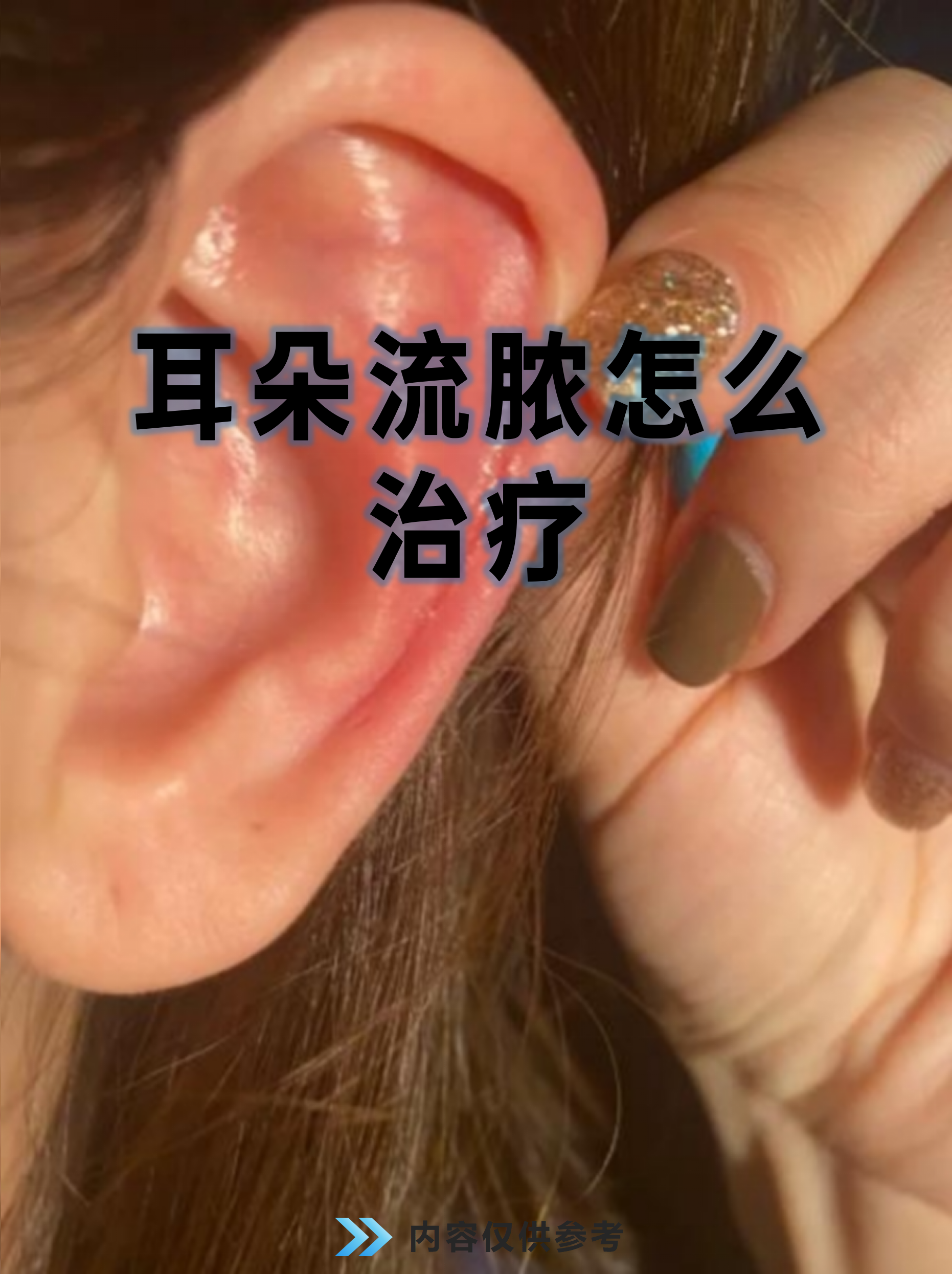 猫咪耳朵发炎流脓了怎么办(猫咪耳朵发炎流脓了怎么办啊) 猫咪耳朵发炎流脓了怎么办(猫咪耳朵发炎流脓了怎么办啊)