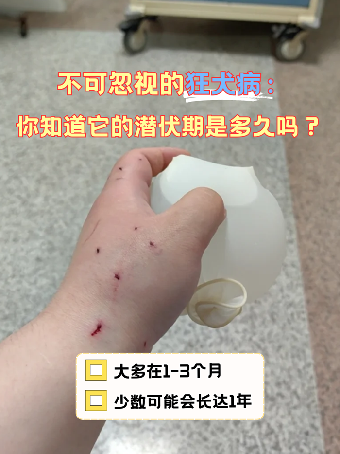 猫爪子上有狂犬病毒么(猫爪子上有狂犬病毒的概率)