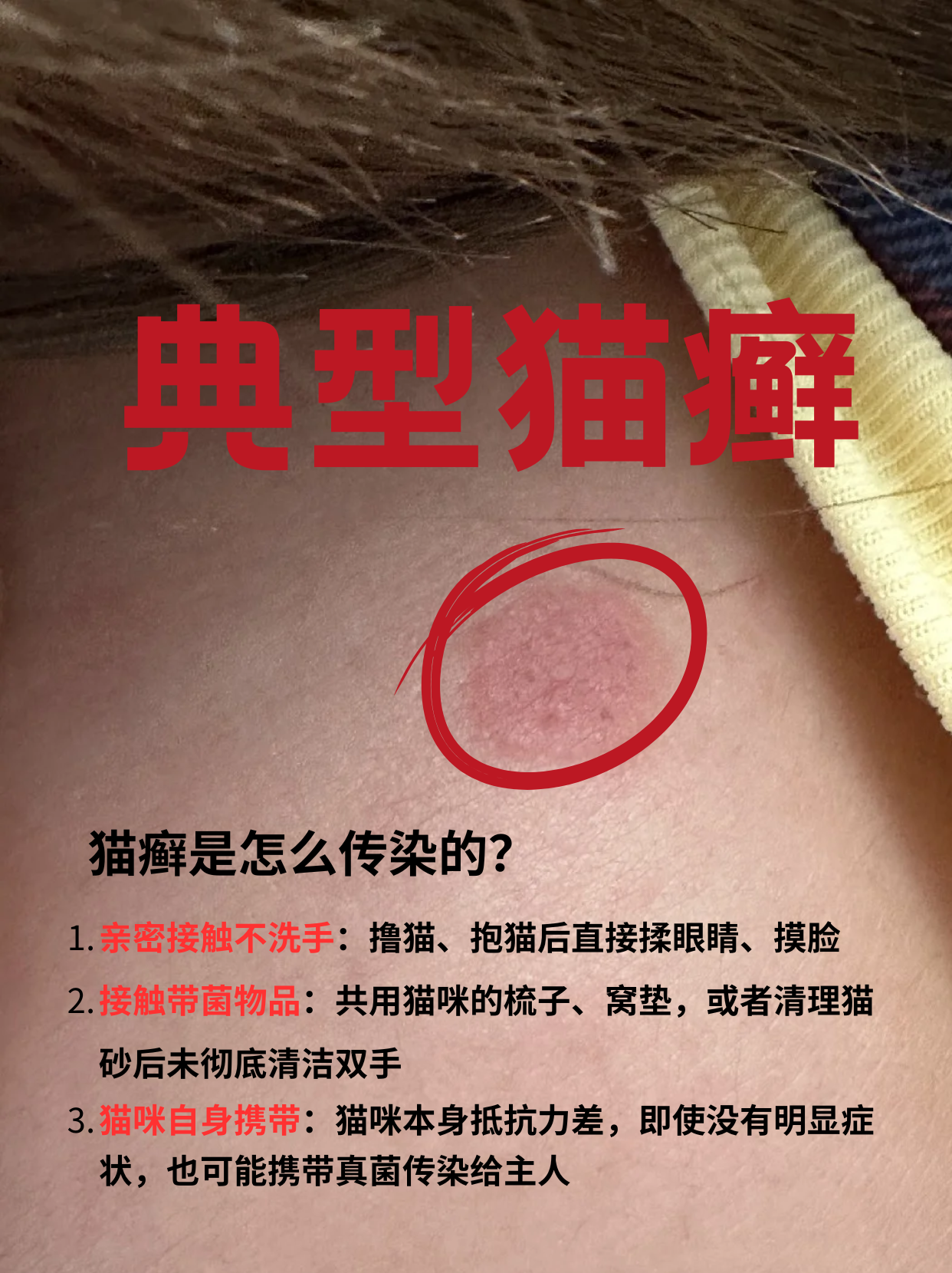 被猫咬了发病的前兆(被猫咬了发病的前兆是什么) 被猫咬了发病的前兆(被猫咬了发病的前兆是什么)
