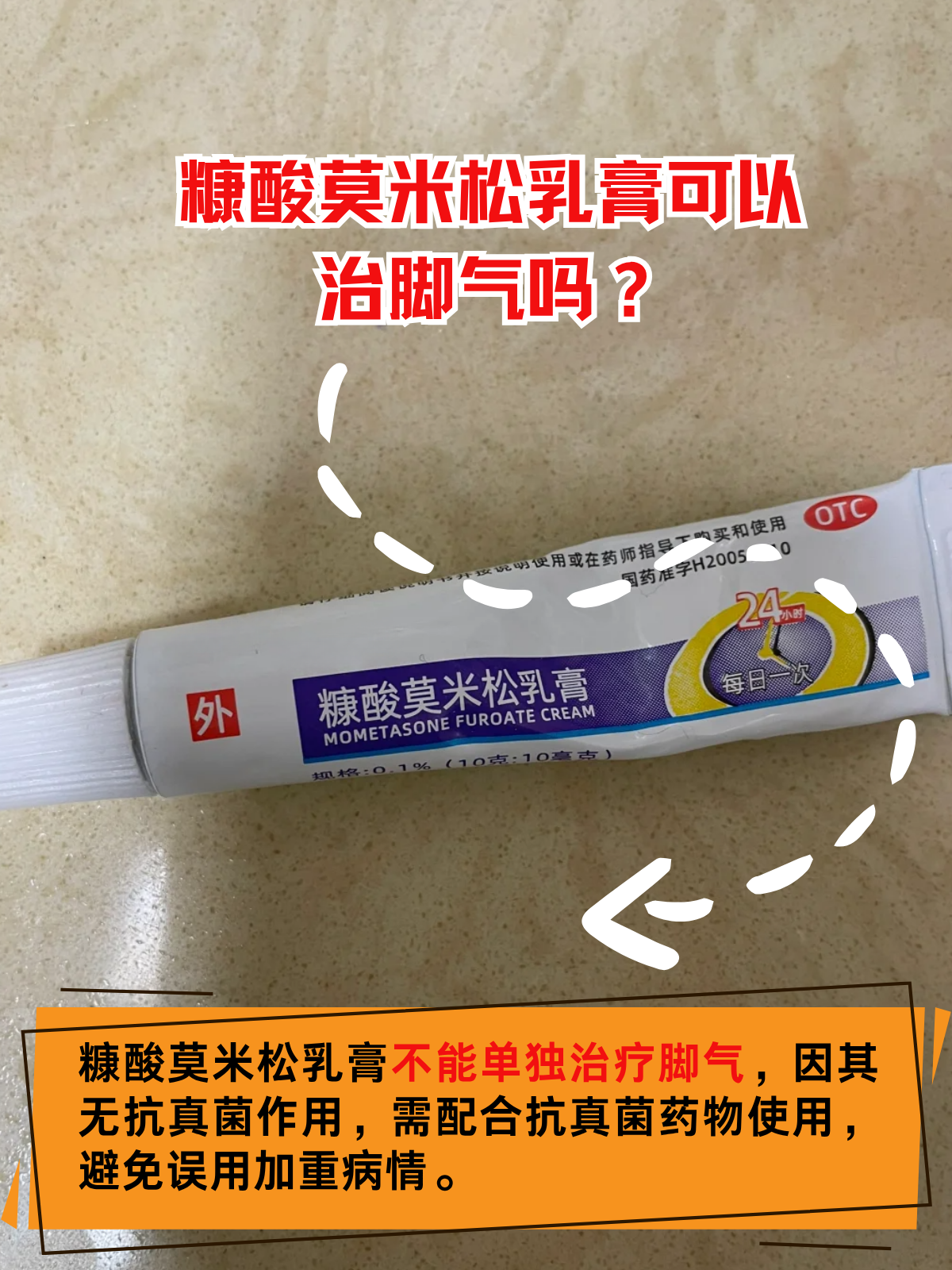 人得猫藓擦什么药膏(人得了猫藓买什么药膏) 人得猫藓擦什么药膏(人得了猫藓买什么药膏)