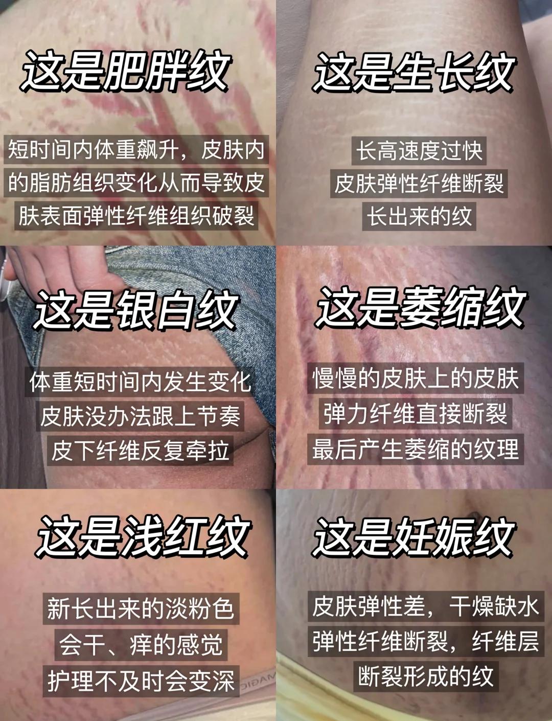 鱼骨纹和虎斑纹区别(鱼骨纹的虎斑值不值得买)