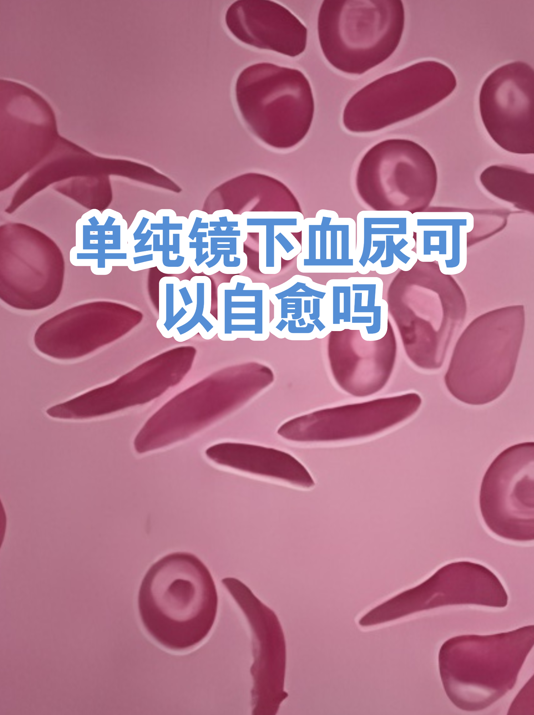 猫咪尿血能自愈吗(猫咪尿血能自愈吗公猫会死吗)