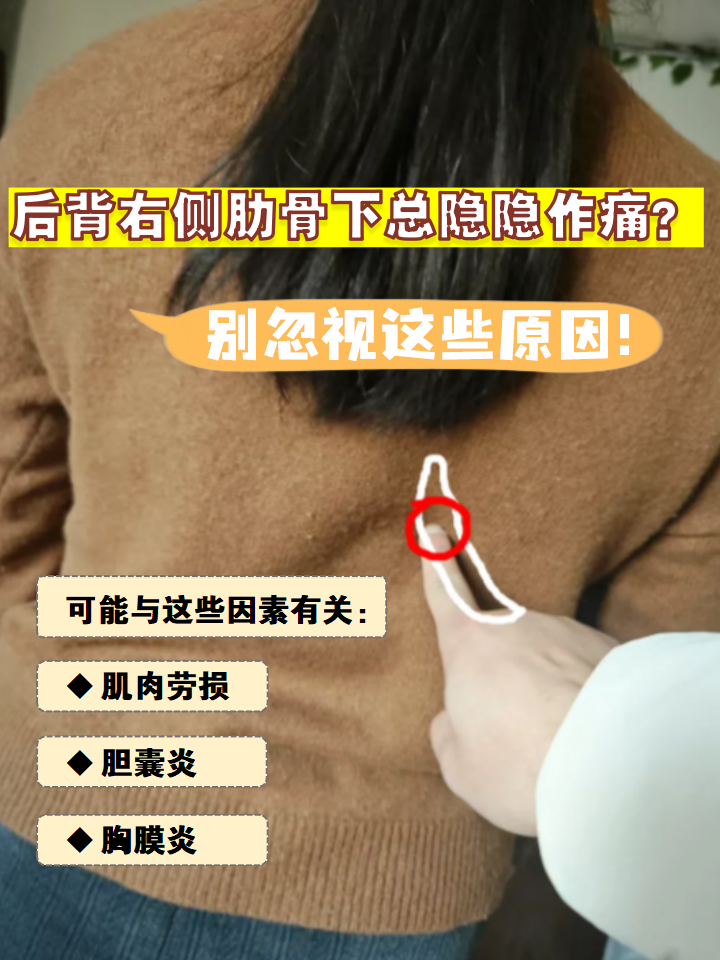 肋间神经痛都有哪些表现(肋间神经痛有什么严重后果)