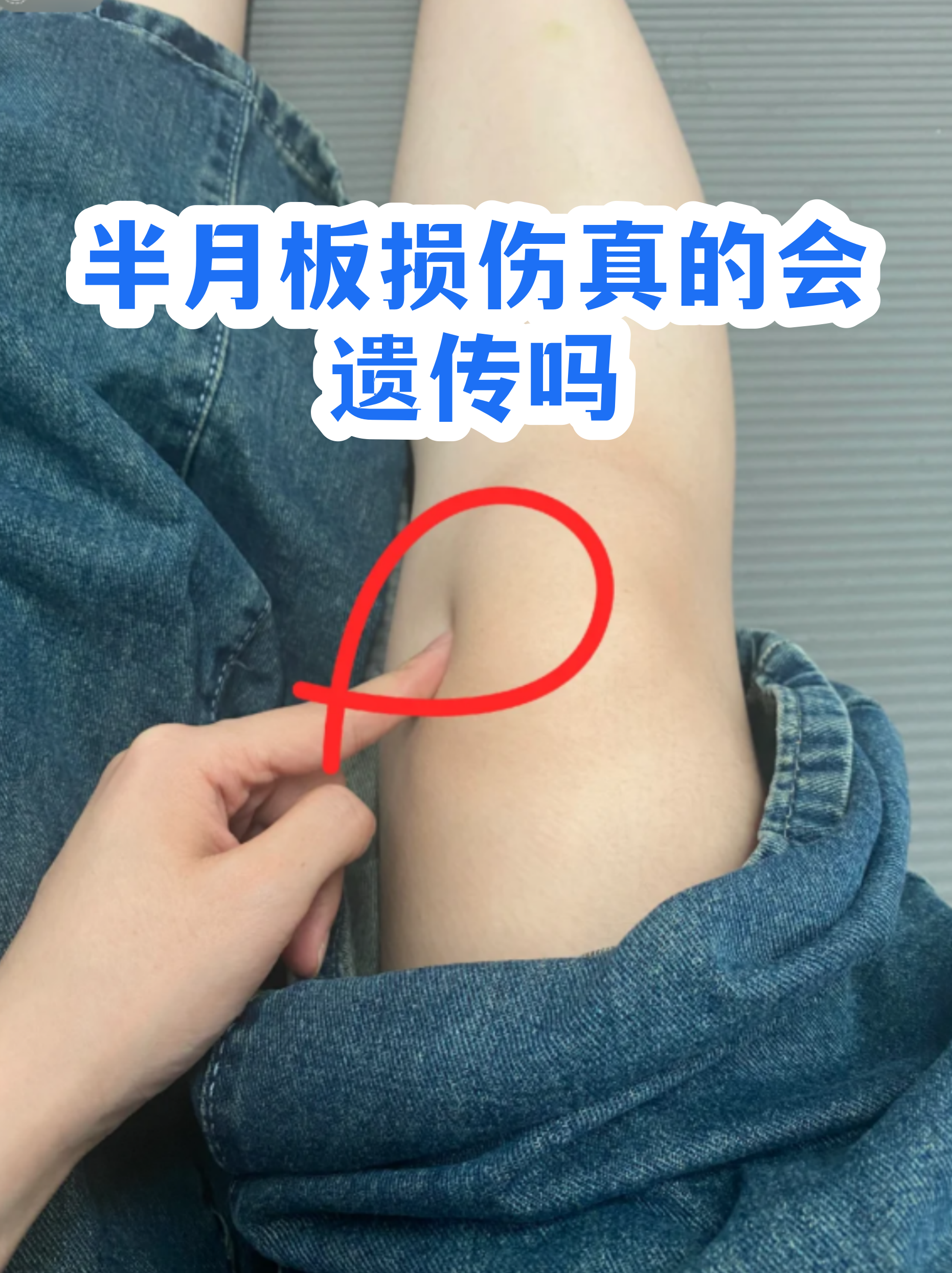 半月板损伤一辈子完蛋了(半月板损伤后能够再次愈合吗)