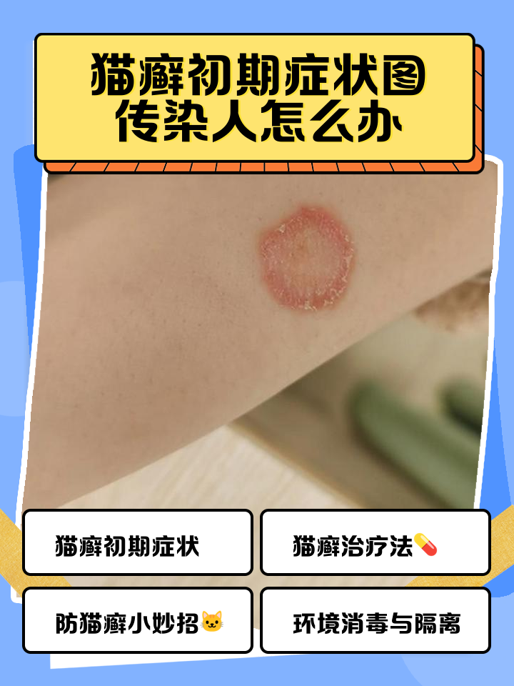 洁尔阴治猫癣太好用了(洁尔阴治猫癣太好用了?猫癣用洁尔阴可以治么)